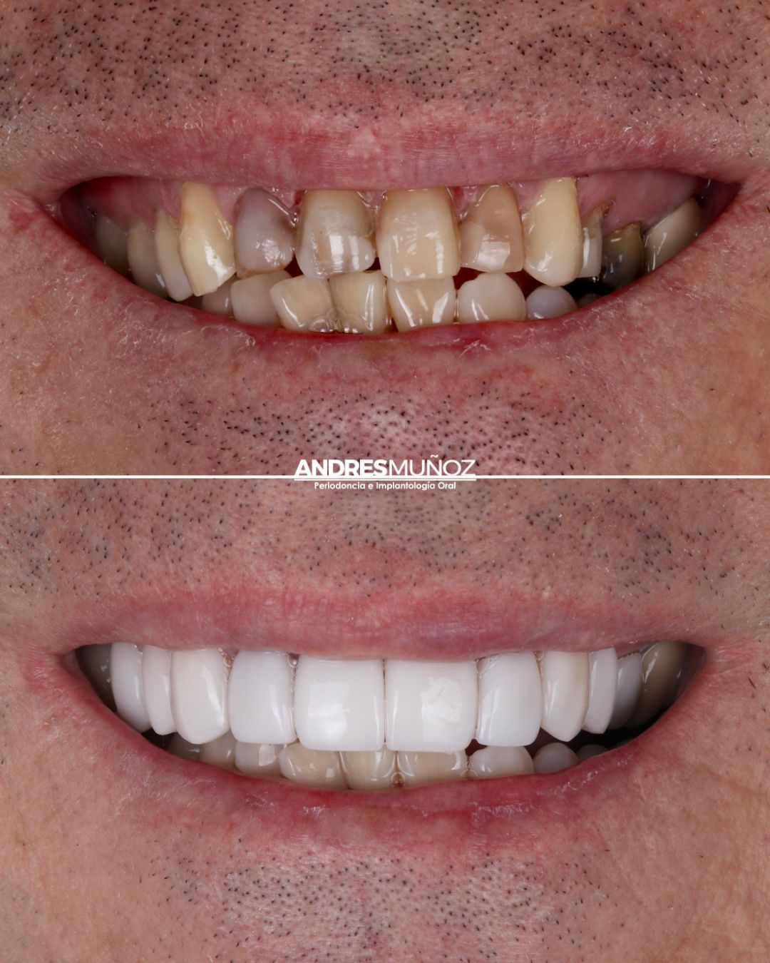 ESTÉTICA DENTAL