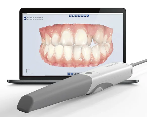 Escáner intraoral y Escáner facial