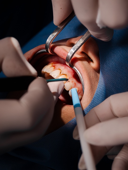 Periodoncia
