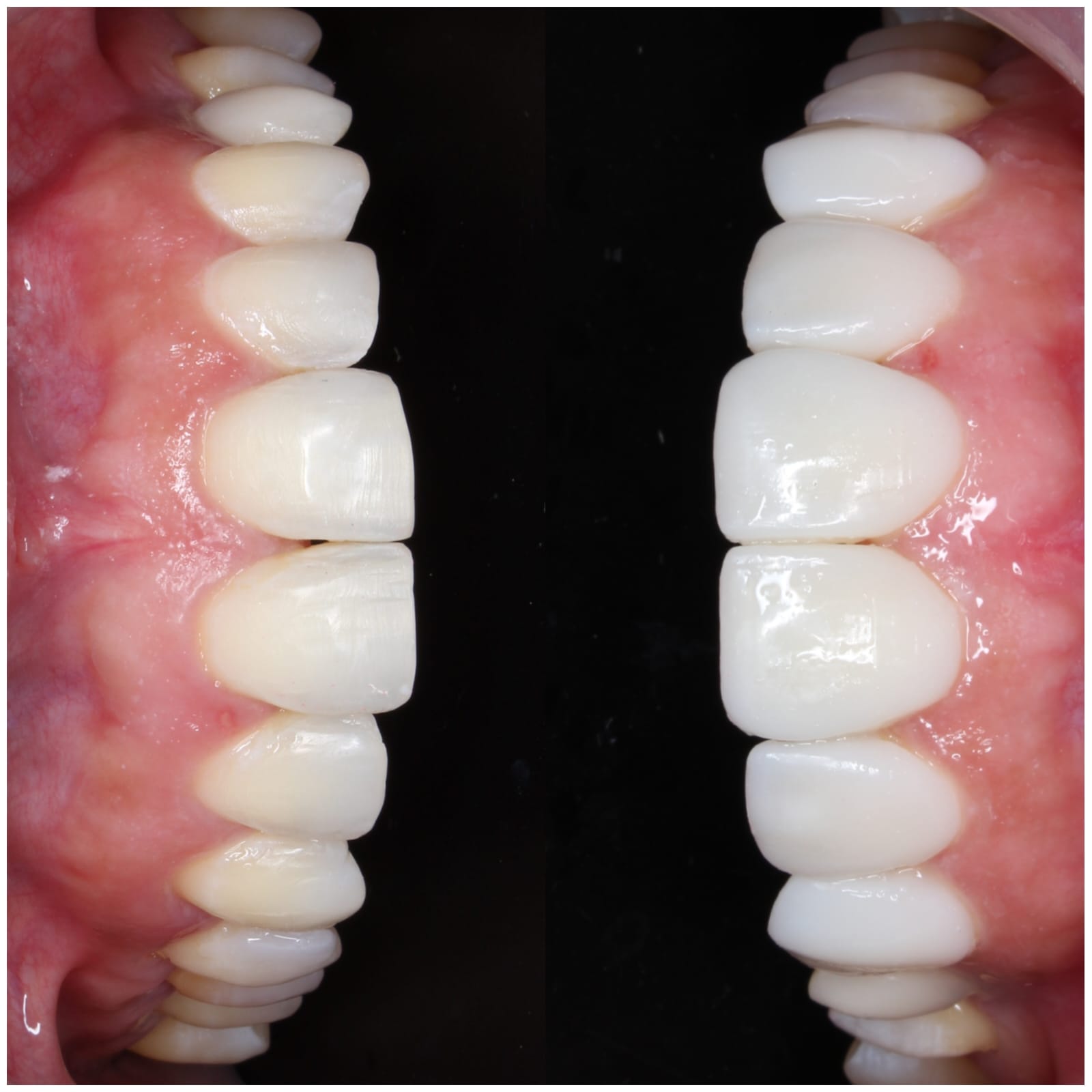 Odontología Estética